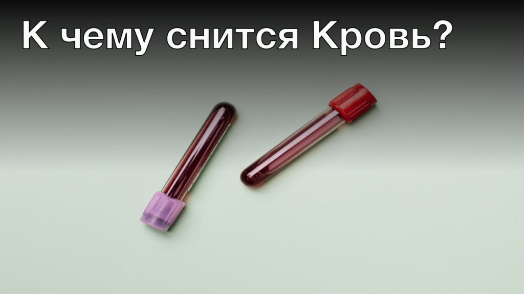К Чему Снится Кровь: Толкования и Символика во Снах
